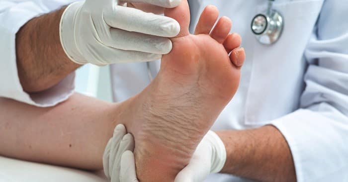 دررفتگی پا کاهش درد و ورم دررفتگی قوزک، انگشت، مچ و کف پا