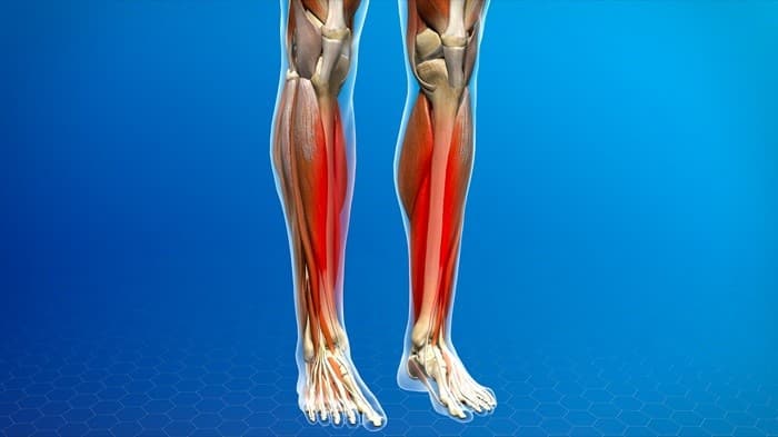 شین اسپلینت (درد جلوی ساق پا) نشانه چیست و چگونه درمان میشود؟